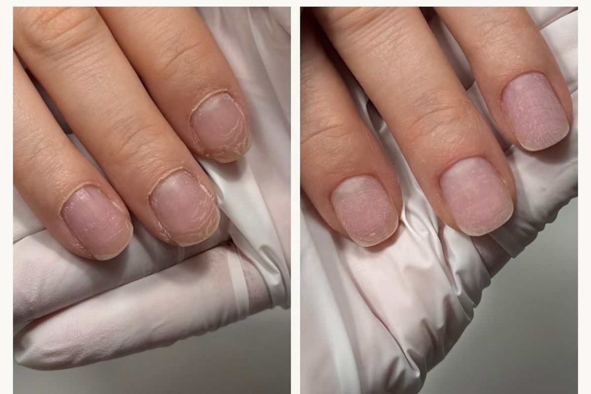 Before and after: overgrown cuticles, then a clean cuticle line after a dry e-file manicure