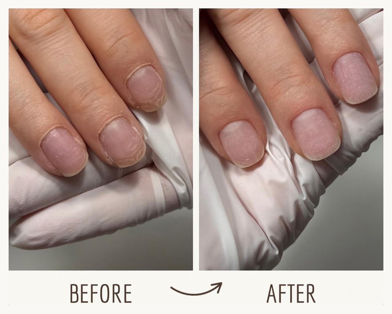 Before and after manicure results